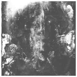 Sedation cover